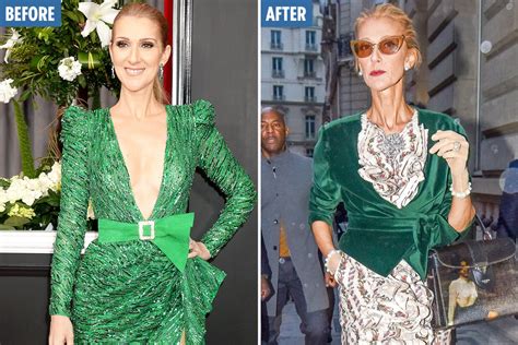 celine before and after|Celine dion latest news.